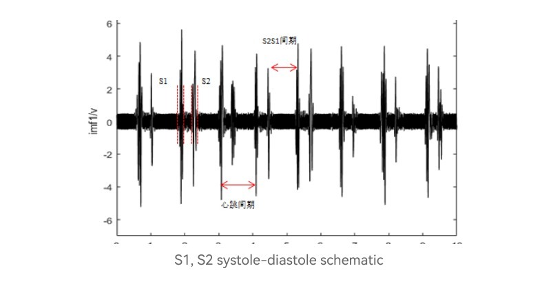 Schematic to show S1 + S2 Signal Structure